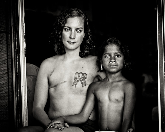 Portrait of young breast cancer survivor The SCAR Project