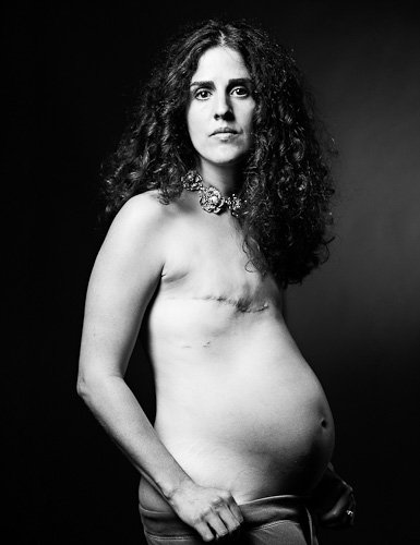 Portrait of breast cancer survivor from The SCAR Project